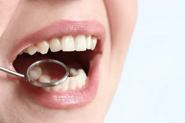 dental checkups near you