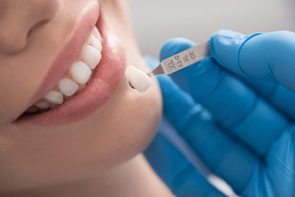dental crowns in vienna wv