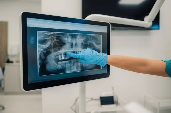 digital dental x rays near you