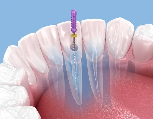 endodontics near you