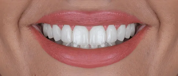 smile makeovers in vienna wv