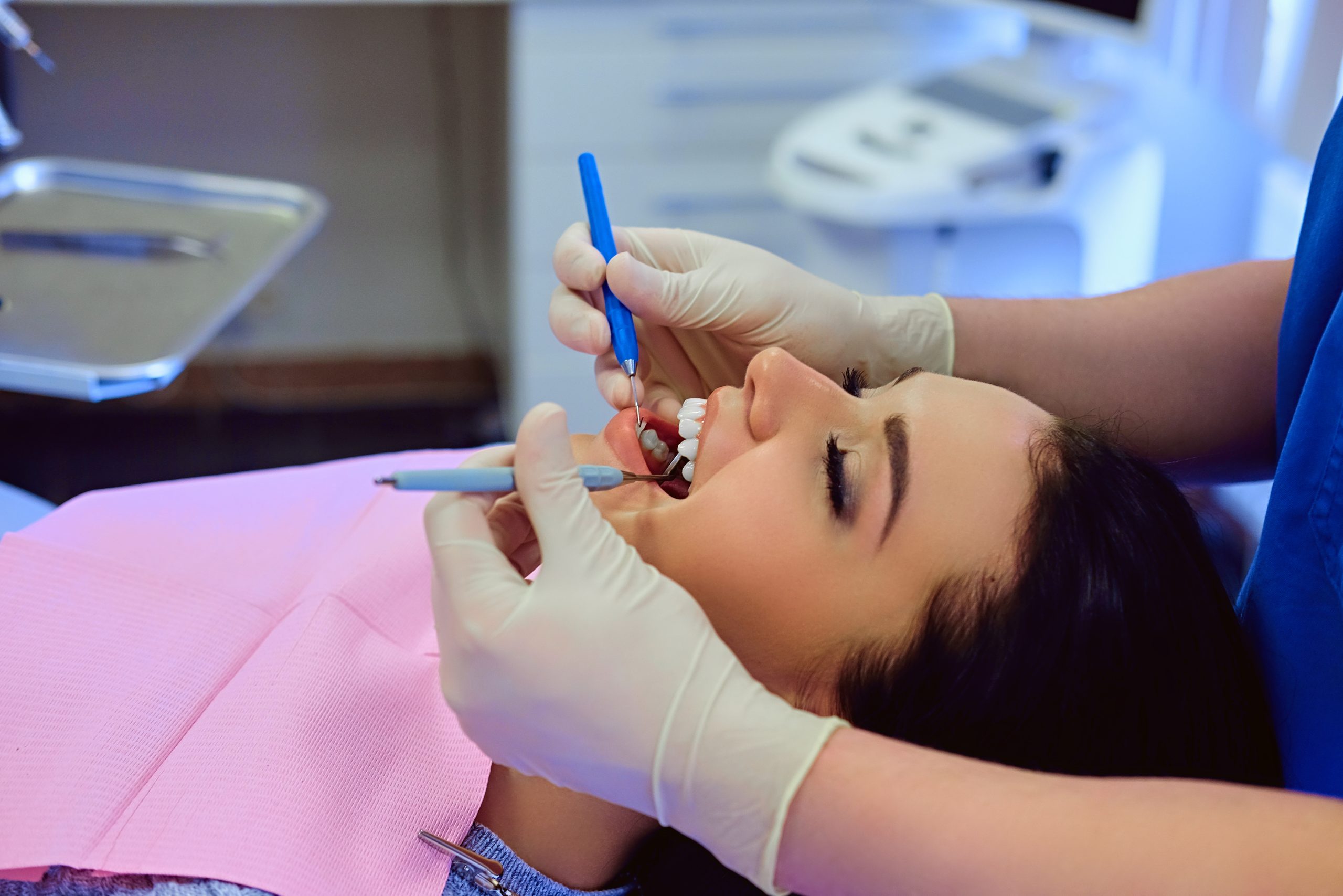 What Are the Signs That You May Need Dental Bonding?